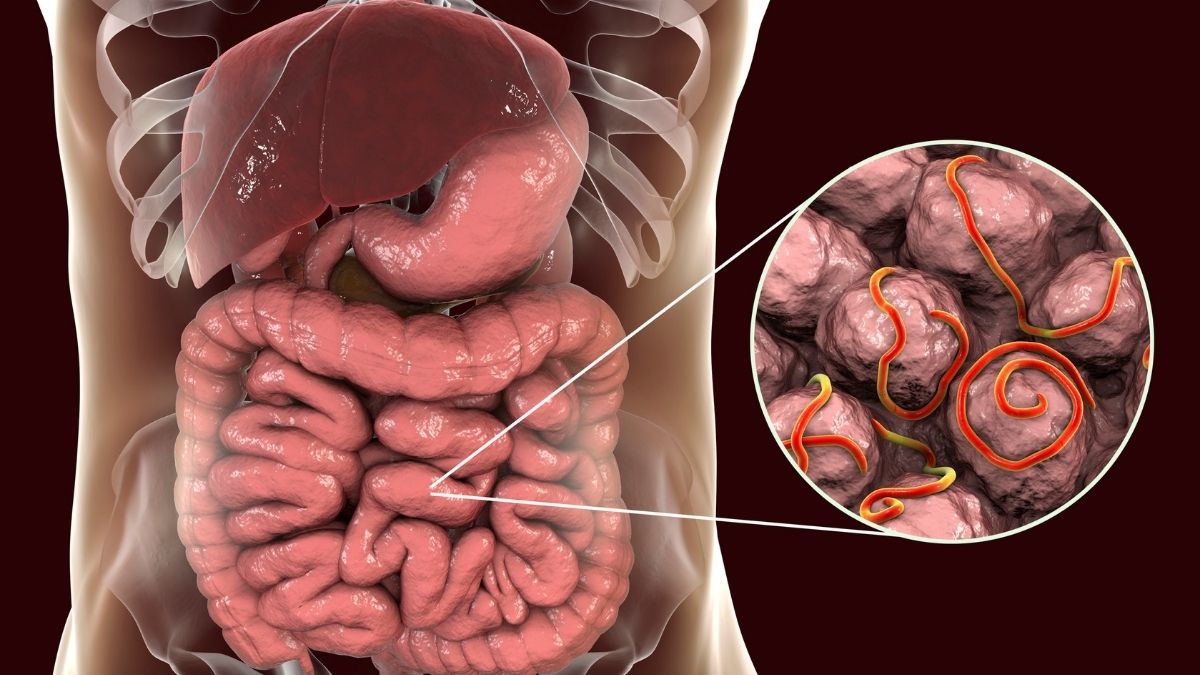 A saúde intestinal influencia a digestão dos alimentos?