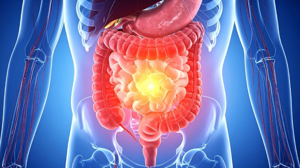 A saúde intestinal melhora com ingestão de frutas e vegetais?