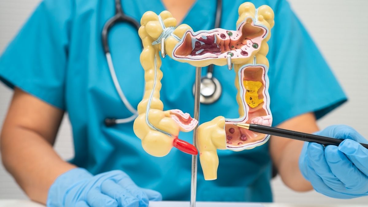 A saúde intestinal pode ser protegida com dieta equilibrada?